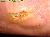 100225andre_ledderhose01.jpg