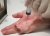 130213hand_nadelfasziotomie_gross.jpg